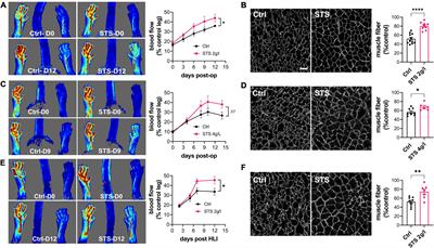 Sodium thiosulfate, a source of hydrogen sulfide, stimulates endothelial cell proliferation and neovascularization